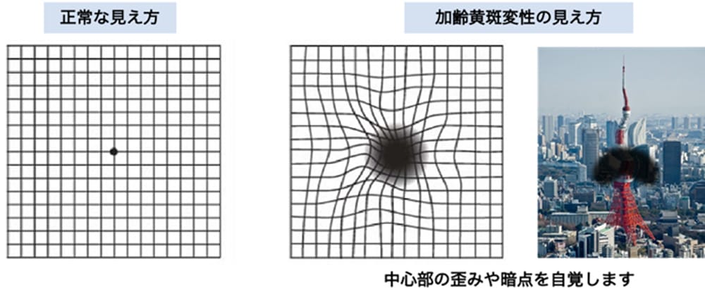 格子状の表